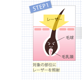 対象の部位にレーザーを照射