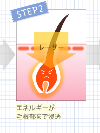 エネルギーが毛根部まで浸透
