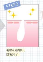 毛根を破壊
