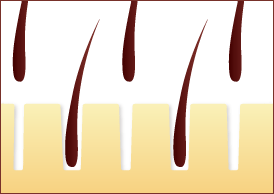 青ヒゲの方は間隔をあけて