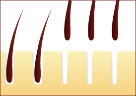 部分的に整えてヒゲデザイン