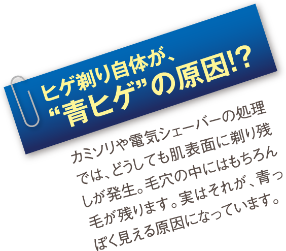 ヒゲ剃り自体が、“青ヒゲ”の原因!?：カミソリや電気シェーバーの処理では、どうしても肌表面に剃り残しが発生。毛穴の中にはもちろん毛が残ります。実はそれが、青っぽく見える原因になっています。