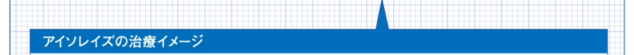 アイソレイズの治療イメージ