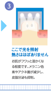 ここで光を照射 熱さはほぼありません