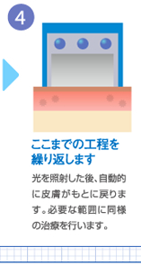 ここまでの工程を 繰り返します
