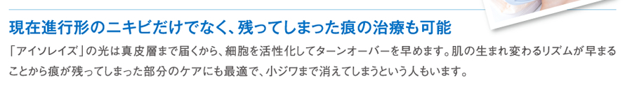 現在進行形のニキビだけでなく、残ってしまった痕の治療も可能