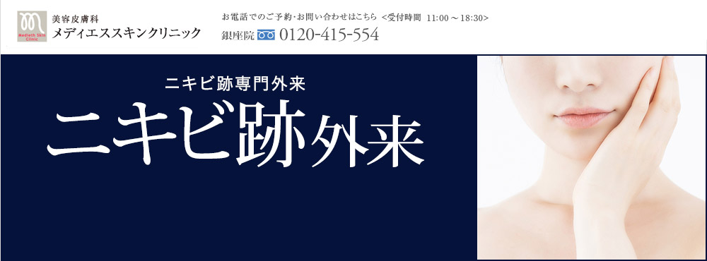 美容皮膚科メディエススキンクリニック お電話でのご予約・お問い合わせはこちら TEL0120-559-935 ニキビ・ニキビ跡専門外来 メディエスクリニックのニキビ・ニキビ跡外来 +圧倒的な症例数 +先進メディカルマシン +経験豊富なドクター陣 まずはご相談下さい