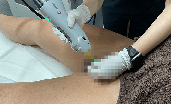 レビュー1のイメージ画像