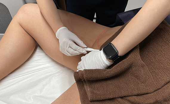 レビュー2のイメージ画像