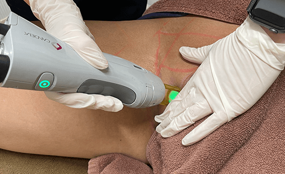 レビュー4のイメージ画像