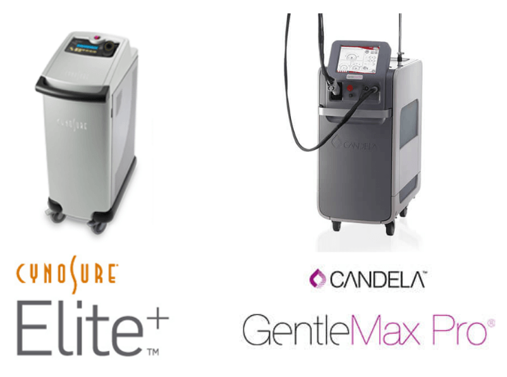 PermanentHairRemovel02